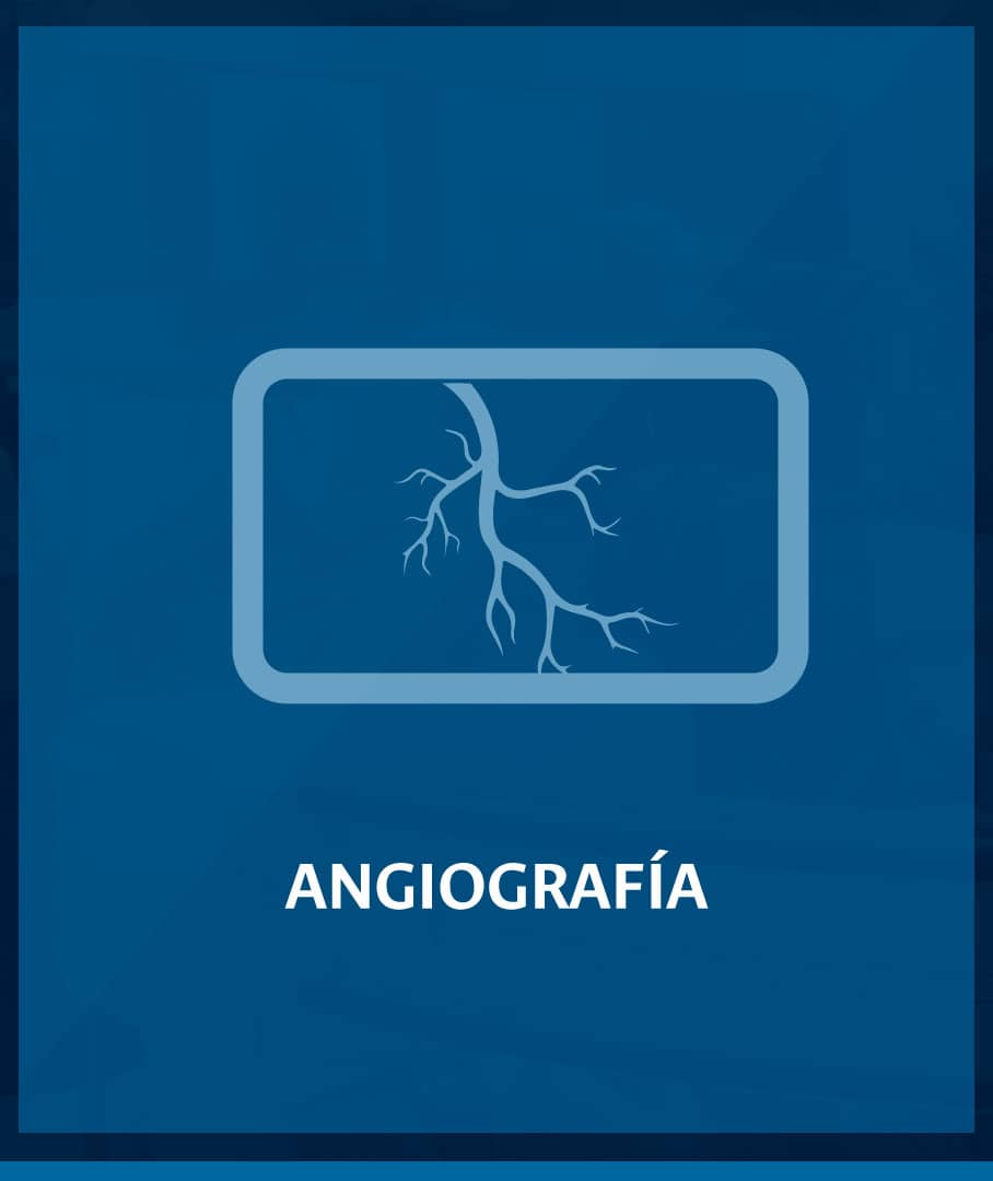 angiografía