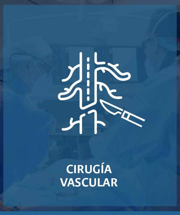 cirugía vascular