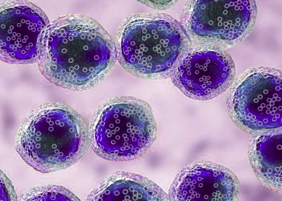Linfoma
