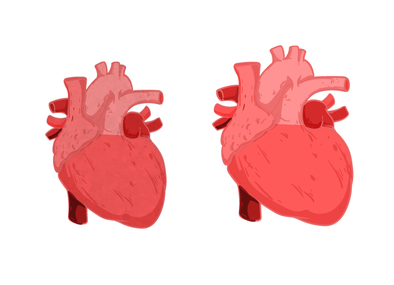 icono que representa agrandamiento del corazón